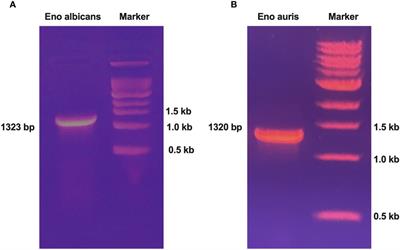 Molecular cloning, expression, and purification, along with in silico epitope analysis of recombinant enolase proteins (a potential vaccine candidate) from Candida albicans and Candida auris